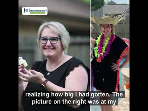 Gastric Sleeve Before And After Story 2022 | Jet Medical Tourism® In Mexico