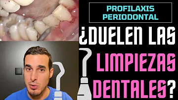 ¿Qué no hacer cuando te limpian los dientes?