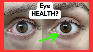 LUMIFY Redness Reliever Eye Drops Review