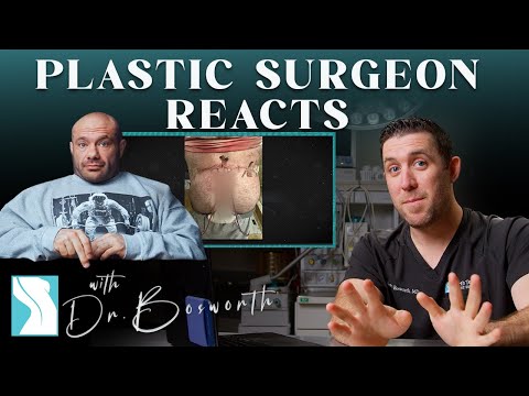 Dr. Mike Gets Plastic Surgery