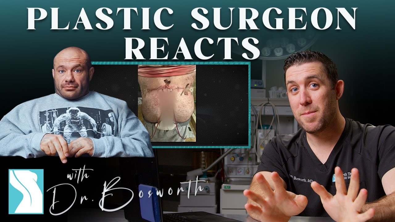 Dr. Mike Gets Plastic Surgery