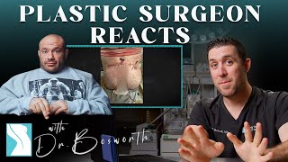 Dr. Mike Gets Plastic Surgery Net Worth