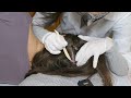 Asmr doctor scalp skin exam with detailed sectioning real person
