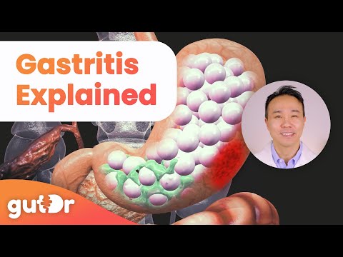 What is Gastritis? | The GutDr Explains (3D Gut Animation)