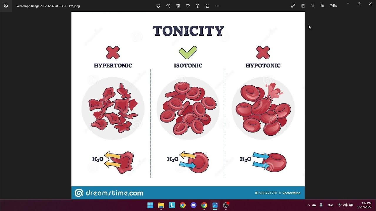 Osmotic fragility test YouTube