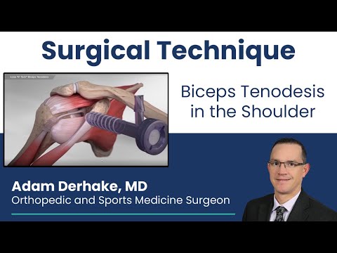 Biceps Tenodesis in the Shoulder: Surgical Technique