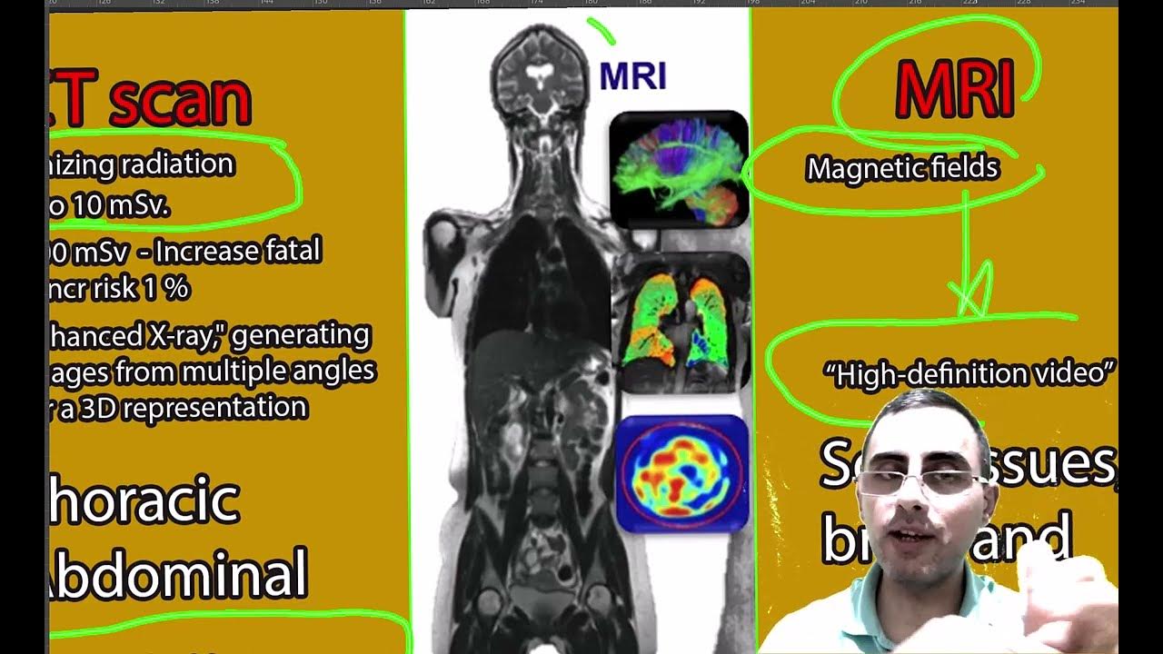 Differences Between Xray Vs CT scan, and MRI. Usage and applications YouTube