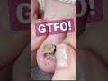 Get The Funk Out Cleaning Under Lifted Nail Meticulousmanicurist Gtfo Cleaning Pedicure Get The Funk Out Cleaning Under Lifted Nail Meticulousmanicurist Gtfo Cleaning Pedicure