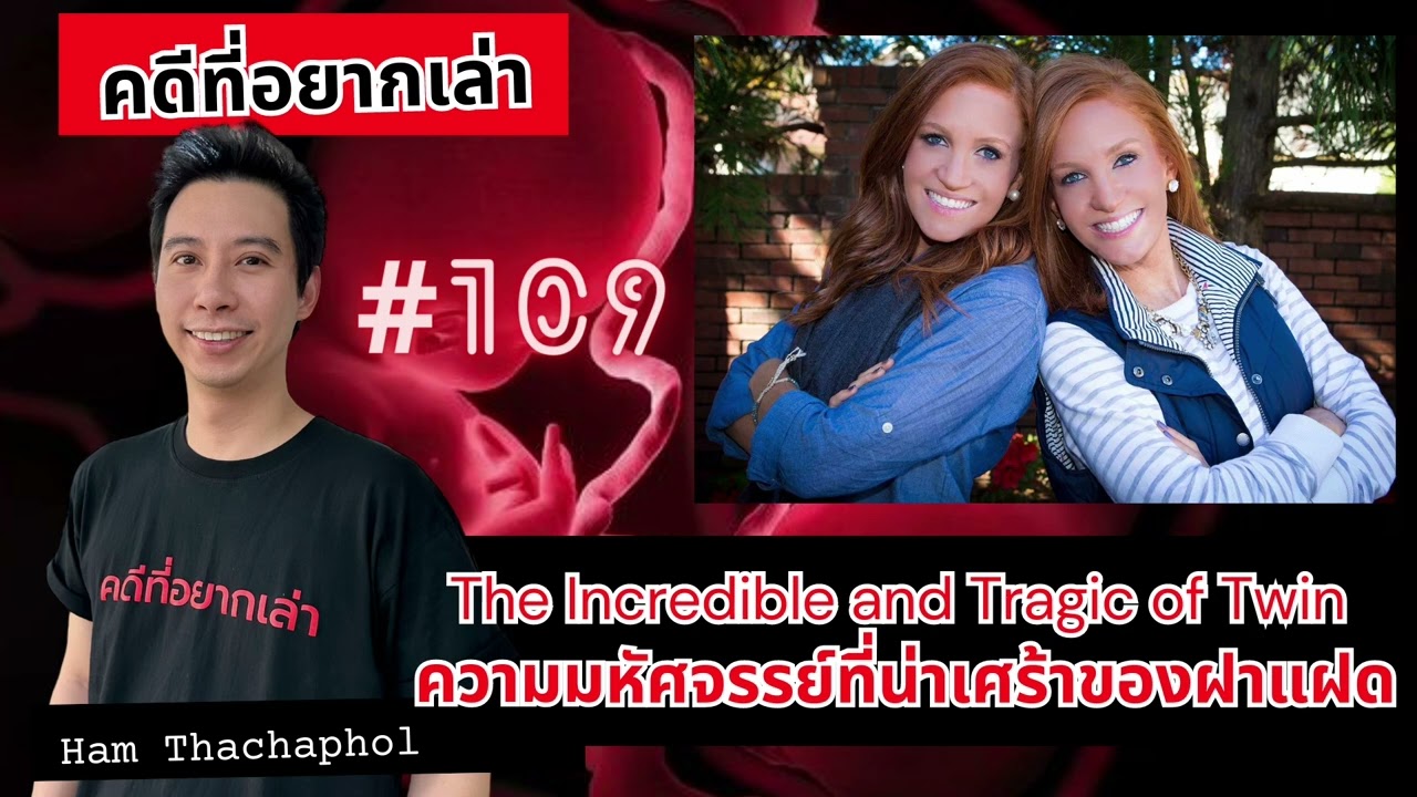 The Incredible and Tragic of Twin ความมหัศจรรย์ที่น่าเศร้าของฝาแฝด