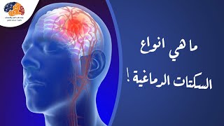 ما هي انواع السكتات الدماغية!