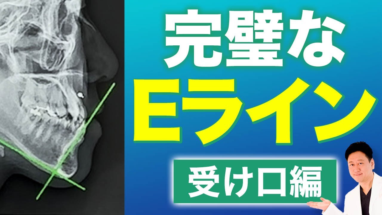 矯正治療だけで改善できる？受け口を改善して綺麗なEラインに！【審美歯科 歯列矯正 歯並び 抜歯 非抜歯】