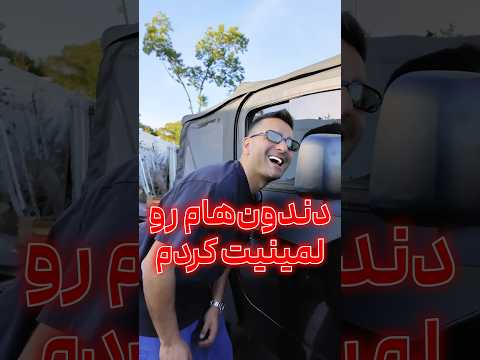 دندون هام رو لمینت کردم