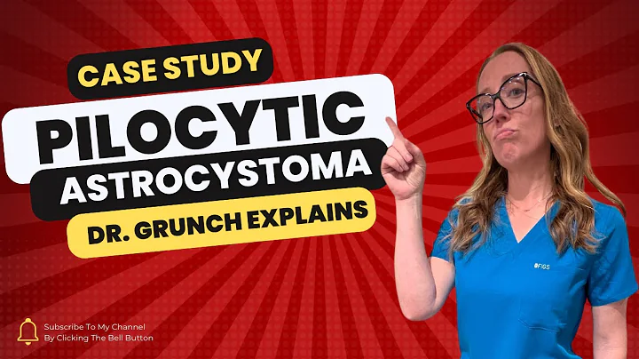 Case study 124 - Pilocytic astrocystoma diagnosis & treatment EXPLAINED by Dr. Grunch, neurosurgeon