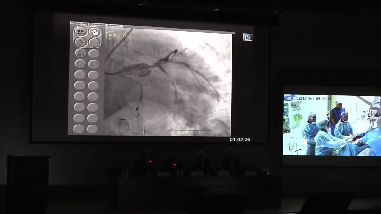 5 курс «Современные принципы лечения острого инфаркта миокарда с ...