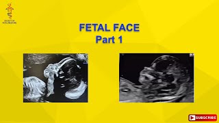 Fetal Face Part 1