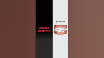 [Shorts] quickView promotional video