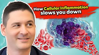 Cellular Inflammation: The Hidden Root of Chronic Fatigue & Burnout