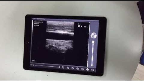 10MHz wireless linear probe 128elements
