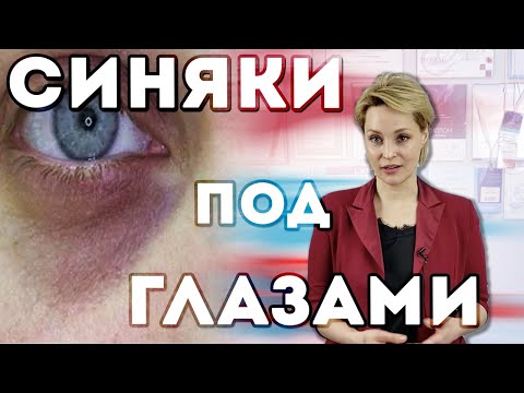 Синяки под глазами из-за ВИТАМИНА Д?