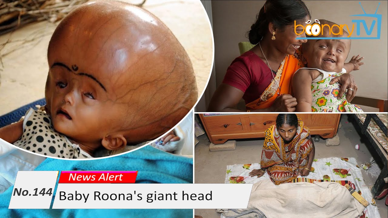 Who Is Roona No. 144, News Alert : Baby Roona's giant head. (ISL) - YouTube