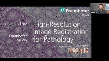High-Resolution Image Registration for Computational Pathology: Johannes Lotz, 21st February 2022