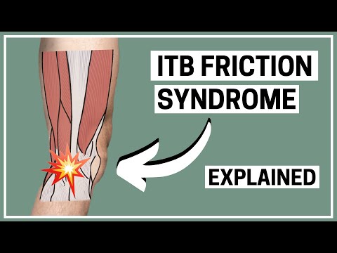 Runners Knee - ITB friction syndrome diagnosis and treatment explained