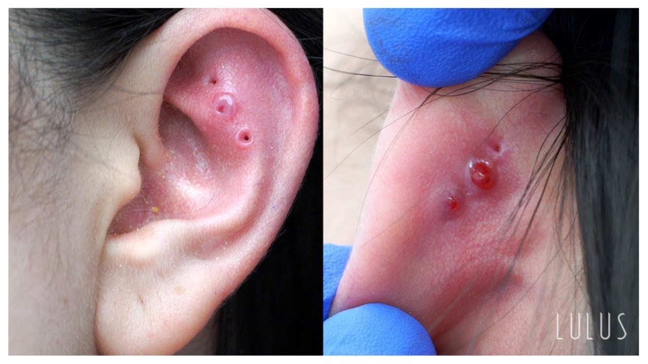 CLEAN Your Piercings Or THIS Can Happen…*REMOVAL* 
