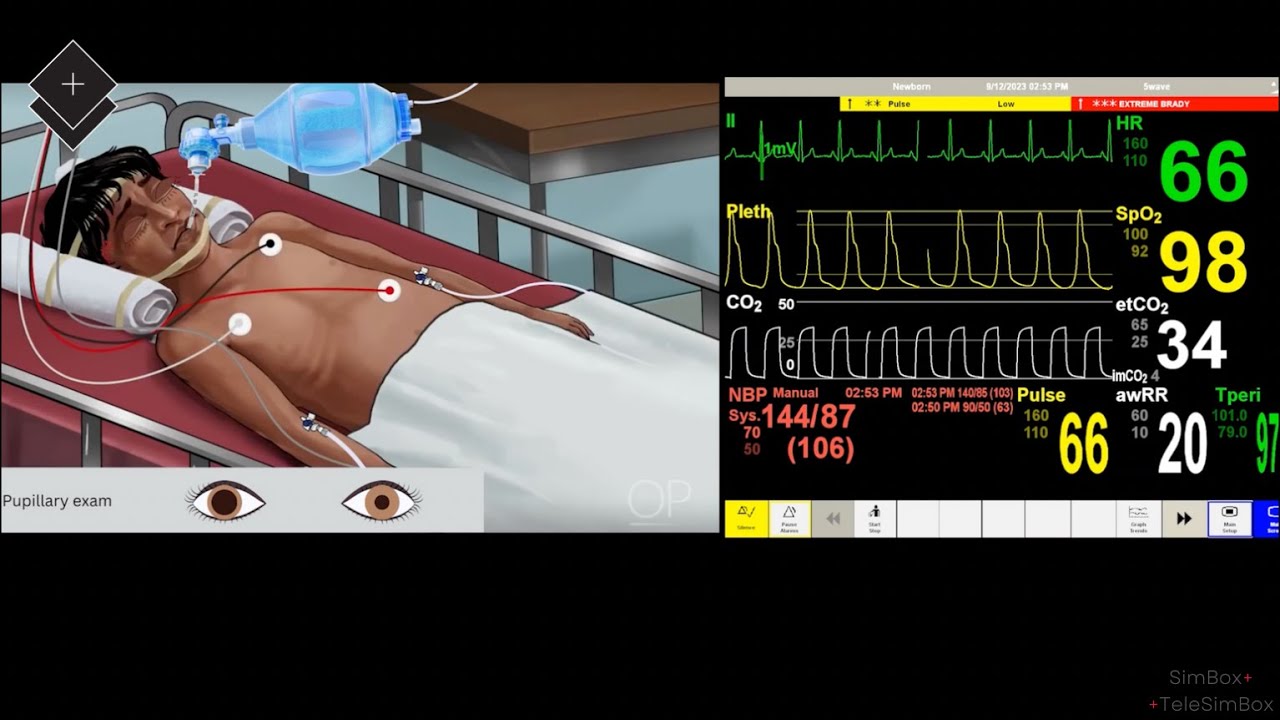 SimBox: A child with Severe Head Injury Video Simulation - YouTube