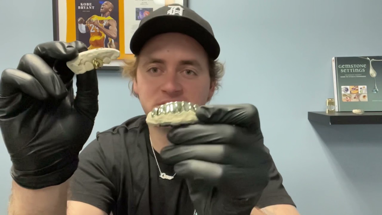 24K vs 10K Yellow Gold & Comparison to White Gold | Luxe Grillz