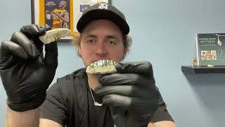 24K vs 10K Yellow Gold & Comparison to White Gold | Luxe Grillz
