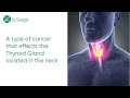 Thyroid cancer  diagnosis symptoms and treatment i dr swagat dash