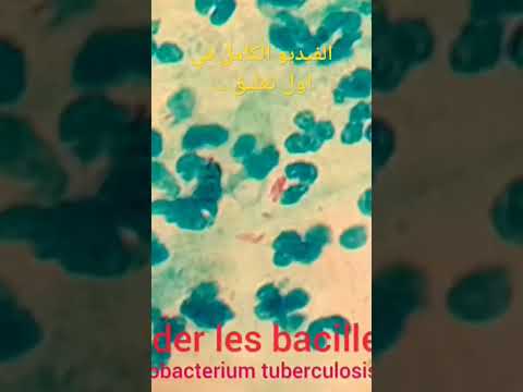 البكتيريا المسببة لمرض السل 