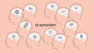 Parkinson’s disease : alpha-synuclein, a major factor ?