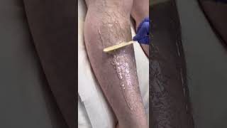 Professional lower leg wax using Starpil Starsoft wax #waxing #esthetician #estheticianlife