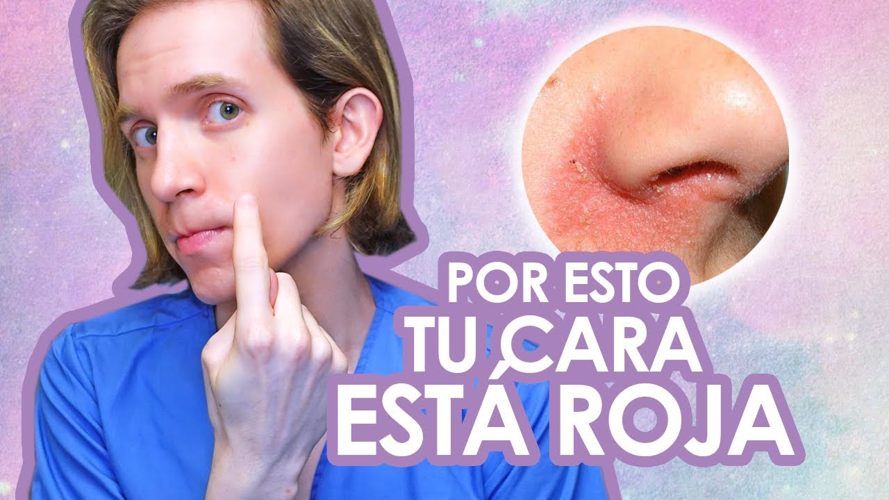 DERMATITIS SEBORREICA: Qué es y cómo se trata? - Recomendaciones de un dermatologo