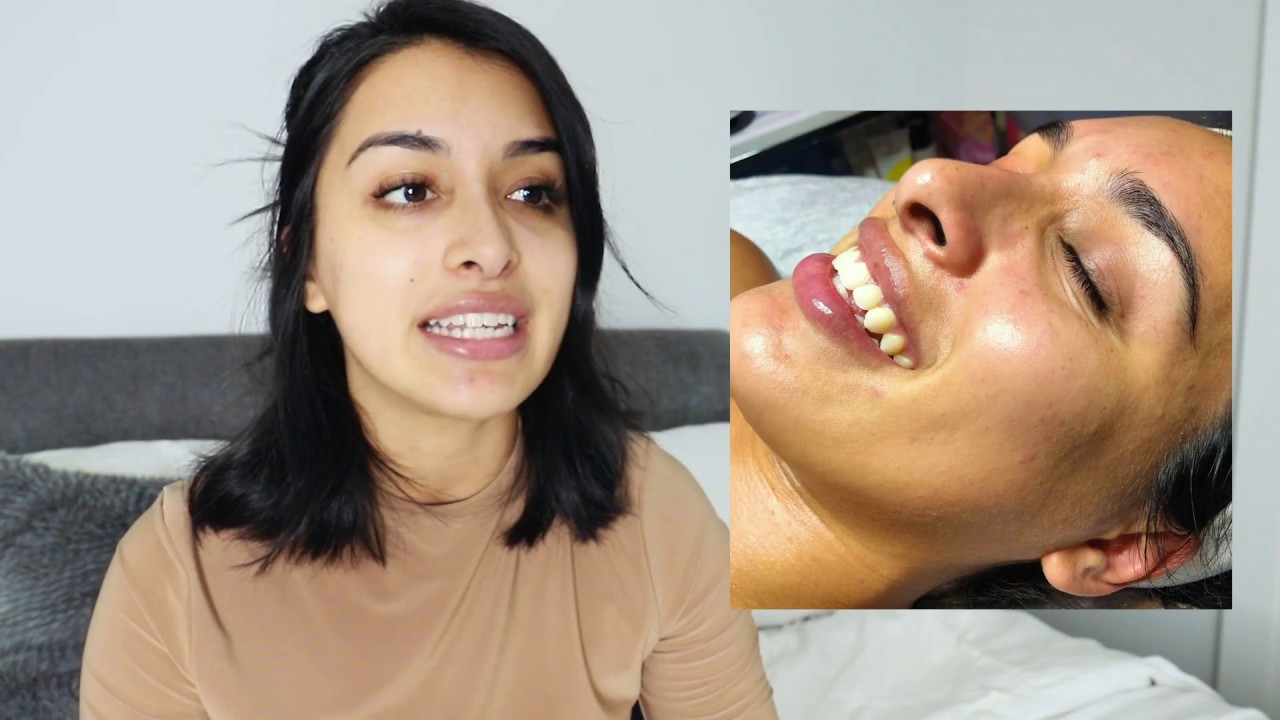 How I Cleared My Breakouts! | Complete Skincare Routine - YouTube