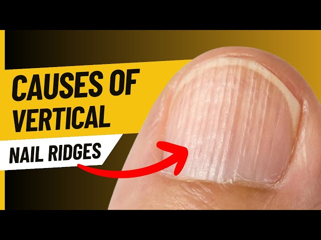 Using The Dry Gloss Manicure for Nail Ridges – Bare Hands