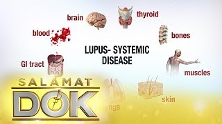 Salamat Dok: Information about lupus