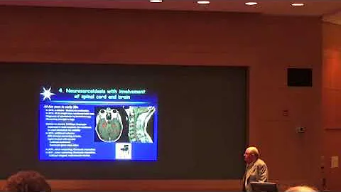 Neurosarcoidosis  Dr. Larry Junck