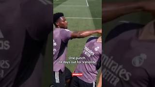 Valverde And Tchouameni Fighting At Training  Diagnosed With A Traumatic Brain Injury 