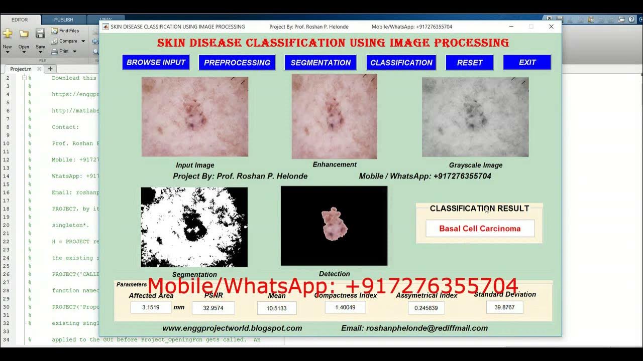 Skin Disease Detection Using Image Processing | With Source Code ...