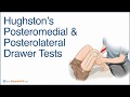 Hughstons posteromedial  posterolateral drawer tests