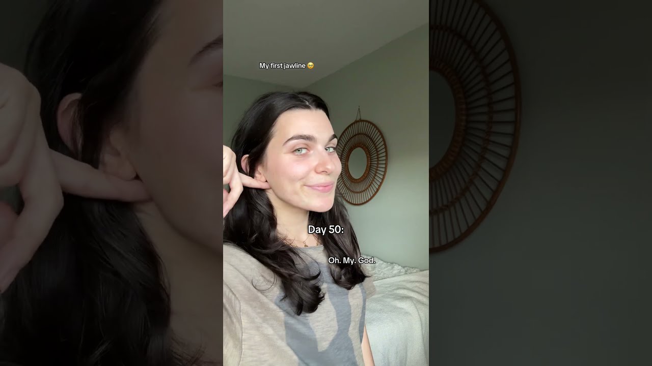Unbelievable Transformation Jawline Beforeandafter