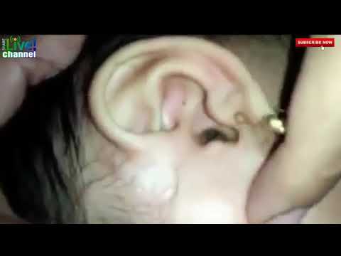 Video: Cara Melepaskan Telinga Anda