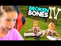 How many bones did madison break playing broken bones 4 with trinity on roblox