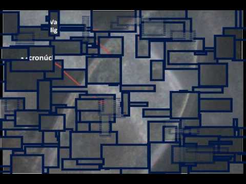 Vídeo: Estructura Basal Del Cuerpo De Paramecium Tetraurelia
