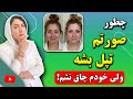 پر شدن صورت در یک هفته با این روش مجرب آموزش بهترین ماسک چاق کننده صورت در خانه