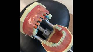 Exploring Anterior DHCA 1411