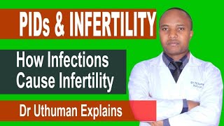 HOW INFECTIONS (PIDs) CAUSE INFERTILITY; failure to get pregnant, treatment, prevention of PID  EP3