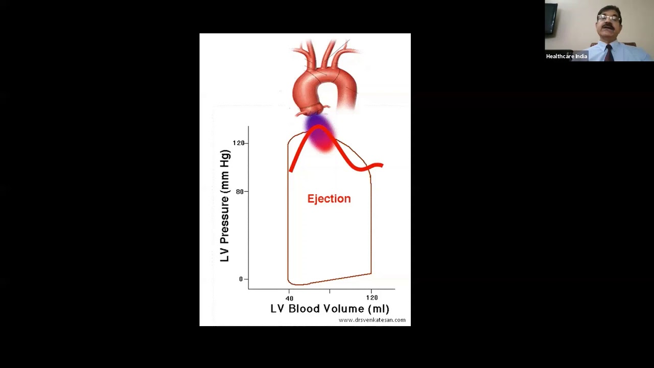 Philips Echo Webinar Series Hemodynamic Assessment in Echocardiography by Dr J C  Mohan, Fortis Hosp